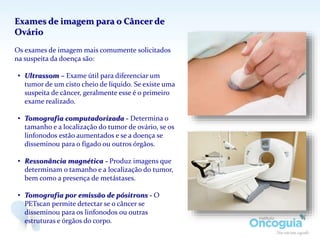 Exames de imagem para o Câncer de
Ovário
Os exames de imagem mais comumente solicitados
na suspeita da doença são:
• Ultrassom – Exame útil para diferenciar um
tumor de um cisto cheio de líquido. Se existe uma
suspeita de câncer, geralmente esse é o primeiro
exame realizado.
• Tomografia computadorizada - Determina o
tamanho e a localização do tumor de ovário, se os
linfonodos estão aumentados e se a doença se
disseminou para o fígado ou outros órgãos.
• Ressonância magnética - Produz imagens que
determinam o tamanho e a localização do tumor,
bem como a presença de metástases.
• Tomografia por emissão de pósitrons - O
PETscan permite detectar se o câncer se
disseminou para os linfonodos ou outras
estruturas e órgãos do corpo.
 
