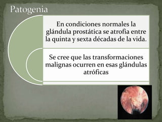 En condiciones normales la
glándula prostática se atrofia entre
la quinta y sexta décadas de la vida.
Se cree que las transformaciones
malignas ocurren en esas glándulas
atróficas
 