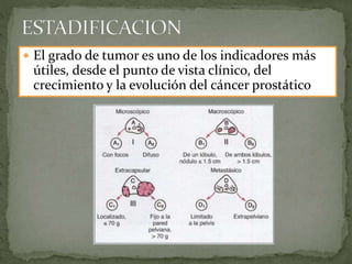  El grado de tumor es uno de los indicadores más
útiles, desde el punto de vista clínico, del
crecimiento y la evolución del cáncer prostático
 