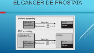 EL CÁNCER DE PRÓSTATA
 