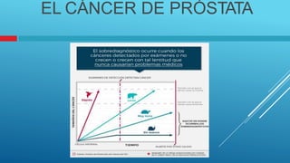 EL CÁNCER DE PRÓSTATA
 