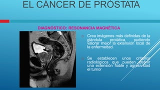 EL CÁNCER DE PRÓSTATA
DIAGNÓSTICO: RESONANCIA MAGNÉTICA
 Crea imágenes más definidas de la
glándula protática, pudiendo
valorar mejor la extensión local de
la enfermedad.
 Se establecen unos criterios
radiológicos que pueden definir
una extensión fiable y agresividad
el tumor
 