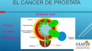 EL CÁNCER DE PRÓSTATA
ESTADIAJE T
,N,M
T=Tumor
N=“Node”
M=Metástasis
 