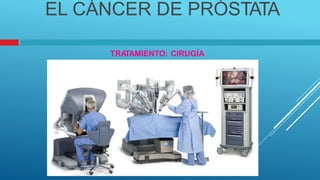 EL CÁNCER DE PRÓSTATA
TRA
TAMIENTO: CIRUGÍA
 