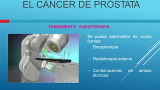 EL CÁNCER DE PRÓSTATA
TRA
TAMIENTO: RADIOTERAPIA
 Se puede administrar
formas:
 Braquiterapia
de varias
 Radioterapia externa
 Combinaciones
técnicas
de ambas
 