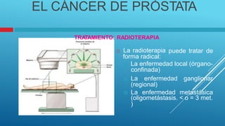 EL CÁNCER DE PRÓSTATA
TRA
TAMIENTO: RADIOTERAPIA
 La radioterapia
forma radical:
puede tratar de
 La enfermedad local (órgano-
confinada)
 La enfermedad ganglionar
(regional)
 La enfermedad metastásica
(oligometástasis. < o = 3 met.
)
 