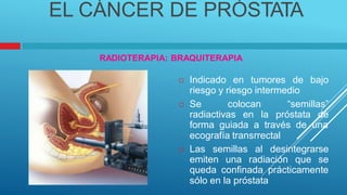 EL CÁNCER DE PRÓSTATA
RADIOTERAPIA: BRAQUITERAPIA
Indicado en tumores de bajo

riesgo y riesgo intermedio
Se colocan “semillas”

radiactivas en la próstata de
forma guiada a través de una
ecografía transrrectal
Las semillas al desintegrarse

emiten una radiación que se
queda confinada prácticamente
sólo en la próstata
 