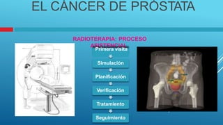 ASISTENCIAL
EL CÁNCER DE PRÓSTATA
RADIOTERAPIA: PROCESO
Primera visita
Simulación
Planificación
Verificación
Tratamiento
Seguimiento
 