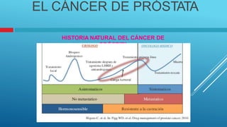 PRÓSTA
TA
EL CÁNCER DE PRÓSTATA
HISTORIA NA
TURAL DEL CÁNCER DE
 