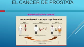 TERAPÉUTICAS
EL CÁNCER DE PRÓSTATA
INMUNOTERAPIA: DIANAS
 