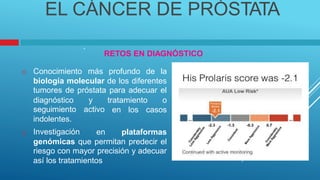 EL CÁNCER DE PRÓSTATA
.
RETOS EN DIAGNÓSTICO
Conocimiento más profundo de la

biología molecular de los diferentes
tumores de próstata para adecuar el
diagnóstico
seguimiento
indolentes.
Investigación
y
activo
tratamiento o
en los casos
en plataformas

genómicas que permitan predecir el
riesgo con mayor precisión y adecuar
así los tratamientos
 