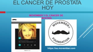 P
EL CÁNCER DE PRÓSTATA
HOY
MOVEMBER Y EL CÁNCER
RÓSTA
TA
DE
https://es.movember.com
 