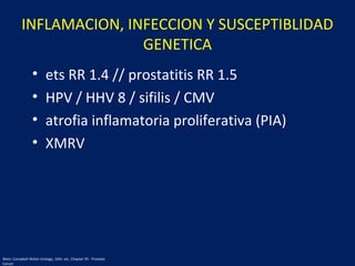 INFLAMACION, INFECCION Y SUSCEPTIBLIDAD
GENETICA
• ets RR 1.4 // prostatitis RR 1.5
• HPV / HHV 8 / sifilis / CMV
• atrofia inflamatoria proliferativa (PIA)
• XMRV
Wein: Campbell-Walsh Urology, 10th. ed.; Chapter 95 - Prostate
Cancer
 