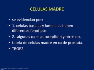 CELULAS MADRE
• se evidencian por:
• 1. celulas basales y luminales tienen
diferentes fenotipos
• 2. algunas ca se autoreplican y otros no.
• teoria de celulas madre en ca de prostata.
• TROP2.
Wein: Campbell-Walsh Urology, 10th. ed.; Chapter 95 - Prostate
Cancer
 