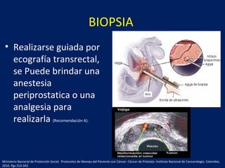 BIOPSIA
• Realizarse guiada por
ecografía transrectal,
se Puede brindar una
anestesia
periprostatica o una
analgesia para
realizarla (Recomendación A).
Ministerio Nacional de Protección Social. Protocolos de Manejo del Paciente con Cáncer. Cáncer de Próstata. Instituto Nacional de Cancerología. Colombia.
2010. Pgs 313-342.
 