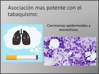 Asociación mas potente con el
tabaquismo:
Carcinomas epidermoides y
microcíticos.
 