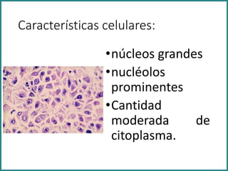Características celulares:
•núcleos grandes
•nucléolos
prominentes
•Cantidad
moderada de
citoplasma.
 