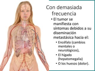 • El tumor se
manifiesta con
síntomas debidos a su
diseminación
metastásica hacia el:
• Encéfalo (cambios
mentales o
neurológicos),
• El hígado
(hepatomegalia)
• O los huesos (dolor).
Con demasiada
frecuencia
 