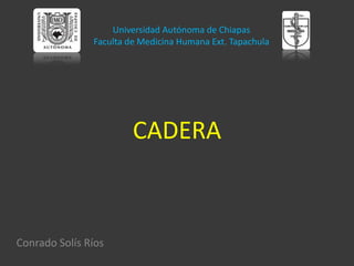 Universidad Autónoma de Chiapas
               Faculta de Medicina Humana Ext. Tapachula




                        CADERA



Conrado Solís Ríos
 