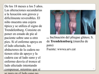 43
De los 18 meses a los 5 años.
Las alteraciones secundarias
a la luxación son graves y
difícilmente reversibles. El
niño muestra una cojera
típica y se utiliza el signo de
Trendelenburg. Consiste en
poner en estado de pie al
paciente sobre uno u otro
pies. Si el enfermo apoya en
el lado afectado, los
abductores de la cadera no
tienen sitio de apoyo y la
cadera cae al lado sano y el
enfermo desvía el tronco al
lado afectado intentando
compensar, mientras que si
... Inclinación del pliegue glúteo; S.
de Trendelemburg (marcha de
pato)
Fuente: wwwa.urv.cat
 