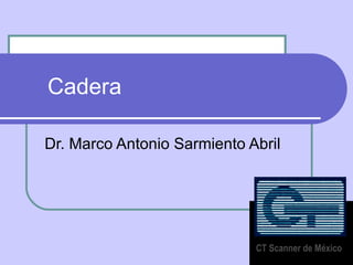 Cadera  Dr. Marco Antonio Sarmiento Abril CT Scanner de México 