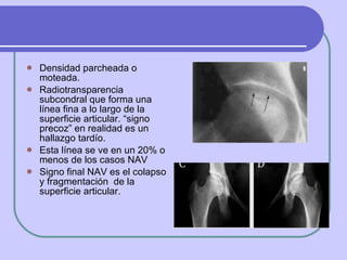 Densidad parcheada o moteada. Radiotransparencia subcondral que forma una línea fina a lo largo de la superficie articular. “signo precoz” en realidad es un hallazgo tardío.  Esta línea se ve en un 20% o menos de los casos NAV  Signo final NAV es el colapso y fragmentación  de la superficie articular.  