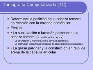 Tomografía Computarizada (TC) <ul><li>Determinar la posición de la cabeza femoral, en relación con la cavidad acetábular. ...