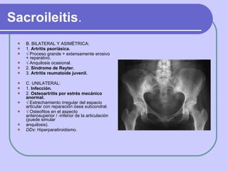 Sacroileitis . <ul><li>B. BILATERAL Y ASIMÉTRICA: </li></ul><ul><li>1.  Artritis psoriásica. </li></ul><ul><li>√  Proceso ...