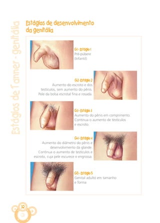 32
Estágios de desenvolvimento
da genitália
EstágiosdeTanner-genitália
G1 - Estágio 1
Pré-púbere
(Infantil)
G2 -Estágio 2
Aumento do escroto e dos
testículos, sem aumento do pênis.
Pele da bolsa escrotal fina e rosada.
G3 - Estágio 3
Aumento do pênis em comprimento.
Continua o aumento de testículos
e escroto.
G4 - Estágio 4
Aumento do diâmetro do pênis e
desenvolvimento da glande.
Continua o aumento de testículos e
escroto, cuja pele escurece e engrossa.
G5 - Estágio 5
Genital adulto em tamanho
e forma
CARTILHA MENINOS 17_4:Layout 1 24/05/2012 13:59 Page 32
 