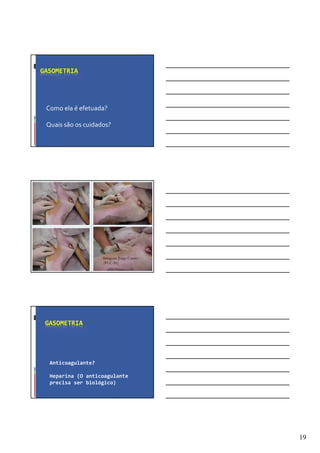 19
GASOMETRIA
Como ela é efetuada?
Quais são os cuidados?
Imagem: Jorge Castro
(PUC-Pr)
GASOMETRIA
Anticoagulante?
Heparina (O anticoagulante
precisa ser biológico)
 
