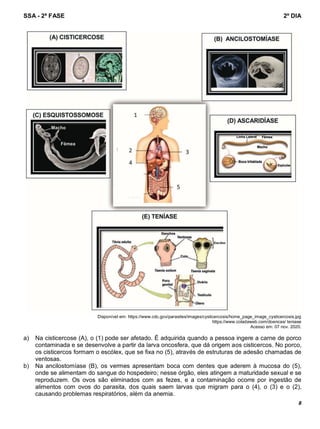 SSA - 2ª FASE 2º DIA
8
Disponível em: https://www.cdc.gov/parasites/images/cysticercosis/home_page_image_cysticercosis.jpg
https://www.coladaweb.com/doencas/ teniase
Acesso em: 07 nov. 2020.
a) Na cisticercose (A), o (1) pode ser afetado. É adquirida quando a pessoa ingere a carne de porco
contaminada e se desenvolve a partir da larva oncosfera, que dá origem aos cisticercos. No porco,
os cisticercos formam o escólex, que se fixa no (5), através de estruturas de adesão chamadas de
ventosas.
b) Na ancilostomíase (B), os vermes apresentam boca com dentes que aderem à mucosa do (5),
onde se alimentam do sangue do hospedeiro; nesse órgão, eles atingem a maturidade sexual e se
reproduzem. Os ovos são eliminados com as fezes, e a contaminação ocorre por ingestão de
alimentos com ovos do parasita, dos quais saem larvas que migram para o (4), o (3) e o (2),
causando problemas respiratórios, além da anemia.
Escólex
 