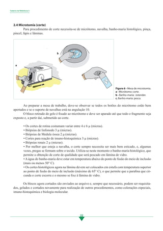 Caderno de Referência 3
• • • • • • • • • • • • • • • • • • •
22
2.4 Microtomia (corte)
	 Para procedimento de corte necessita-se de micrótomo, navalha, banho-maria histológico, pinça,
pincel, lápis e lâminas.
	 Ao preparar a mesa de trabalho, deve-se observar se todos os botões do micrótomo estão bem
apertados e se o suporte de navalhas está na angulação 10.
	 O bloco retirado do gelo é fixado ao micrótomo e deve ser aparado até que todo o fragmento seja
exposto e, a partir daí, submetido ao corte.
• Os cortes de rotina costumam variar entre 4 e 6 µ (micras).
• Biópsias de linfonodo 3 µ (micras).
• Biópsias de Medula óssea 2 μ (micras).
• Cortes para reação de imuno-histoquímica 3 µ (micras).
• Biópsias renais 2 µ (micras).
• Por melhor que esteja a navalha, o corte sempre necessita ser mais bem esticado, e, algumas
vezes, pregas se formam sobre o tecido. Utiliza-se neste momento o banho-maria histológico, que
permite a obtenção de corte de qualidade que será pescado em lâmina de vidro.
• A água do banho-maria deve estar em temperatura abaixo do ponto de fusão do meio de inclusão
(mais ou menos 50° C).
• Os cortes histológicos agora na lâmina devem ser colocados em estufa com temperatura superior
ao ponto de fusão do meio de inclusão (máximo de 65° C), o que permite que a parafina que cir-
cunda o corte escorra e o mesmo se fixe à lâmina de vidro.
	
	 Os blocos agora cortados são enviados ao arquivo e, sempre que necessário, podem ser requisita-
dos, gelados e cortados novamente para realização de outros procedimentos, como colorações especiais,
imuno-histoquímica e biologia molecular.
b
c
a
Figura 6 - Mesa de microtomia.
a - Micrótomo: corte.	
b - Banho-maria: estender.
c. Banho-maria: pesca.
3.indd 22 11/08/12 20:30
 