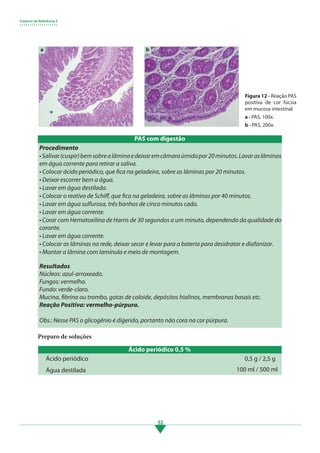 Caderno de Referência 3
• • • • • • • • • • • • • • • • • • •
32
Procedimento
•Salivar(cuspir)bemsobrealâminaedeixaremcâmaraúmidapor20minutos.Lavaraslâminas
em água corrente para retirar a saliva.
• Colocar ácido periódico, que fica na geladeira, sobre as lâminas por 20 minutos.
• Deixar escorrer bem a água.
• Lavar em água destilada.
• Colocar o reativo de Schiff, que fica na geladeira, sobre as lâminas por 40 minutos.
• Lavar em água sulfurosa, três banhos de cinco minutos cada.
• Lavar em água corrente.
• Corar com Hematoxilina de Harris de 30 segundos a um minuto, dependendo da qualidade do
corante.
• Lavar em água corrente.
• Colocar as lâminas na rede, deixar secar e levar para a bateria para desidratar e diafanizar.
• Montar a lâmina com lamínula e meio de montagem.
Resultados
Núcleos: azul-arroxeado.
Fungos: vermelho.
Fundo: verde-claro.
Mucina, fibrina ou trombo, gotas de coloide, depósitos hialinos, membranas basais etc.
Reação Positiva: vermelho-púrpura.
Obs.: Nesse PAS o glicogênio é digerido, portanto não cora na cor púrpura.
Preparo de soluções
Ácido periódico 0,5 %
Ácido periódico
Água destilada
0,5 g / 2,5 g
100 ml / 500 ml
a b
Figura 12 - Reação PAS
positiva de cor fúcsia
em mucosa intestinal.
a - PAS, 100x.
b - PAS, 200x.
PAS com digestão
3.indd 32 11/08/12 20:30
 