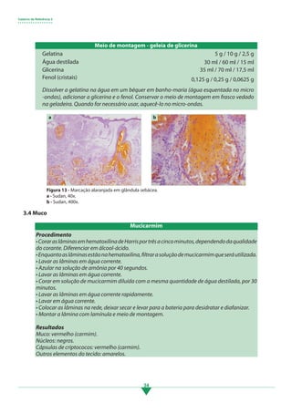 Caderno de Referência 3
• • • • • • • • • • • • • • • • • • •
34
3.4 Muco
Procedimento
•CoraraslâminasemhematoxilinadeHarrisportrêsacincominutos,dependendodaqualidade
do corante. Diferenciar em álcool-ácido.
•Enquantoaslâminasestãonahematoxilina,filtrarasoluçãodemucicarmimqueseráutilizada.
• Lavar as lâminas em água corrente.
• Azular na solução de amônia por 40 segundos.
• Lavar as lâminas em água corrente.
• Corar em solução de mucicarmim diluída com a mesma quantidade de água destilada, por 30
minutos.
• Lavar as lâminas em água corrente rapidamente.
• Lavar em água corrente.
• Colocar as lâminas na rede, deixar secar e levar para a bateria para desidratar e diafanizar.
• Montar a lâmina com lamínula e meio de montagem.
Resultados
Muco: vermelho (carmim).
Núcleos: negros.
Cápsulas de criptococos: vermelho (carmim).
Outros elementos do tecido: amarelos.
Meio de montagem - geleia de glicerina
Gelatina
Água destilada
Glicerina
Fenol (cristais)
5 g / 10 g / 2,5 g
30 ml / 60 ml / 15 ml
35 ml / 70 ml / 17,5 ml
0,125 g / 0,25 g / 0,0625 g
a b
Figura 13 - Marcação alaranjada em glândula sebácea.
a - Sudan, 40x.
b - Sudan, 400x.
Mucicarmim
Dissolver a gelatina na água em um béquer em banho-maria (água esquentada no micro
-ondas), adicionar a glicerina e o fenol. Conservar o meio de montagem em frasco vedado
na geladeira. Quando for necessário usar, aquecê-lo no micro-ondas.
3.indd 34 11/08/12 20:30
 