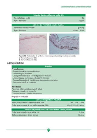 37
Solução de tiossulfato de sódio 2%
Tiossulfato de sódio
Água destilada
2 g
100 ml
Solução de vermelho-neutro nuclear
Vermelho-neutro nuclear
Água destilada
1 g / 0,5 g
100 ml / 50 ml
Figura 15 - Melanócitos da epiderme mostrando positividade granular e escurecida.
a - Fontana Massom, 100x.
b - Fontana Massom, 200x.
a b
3.6 Pigmento biliar
Preparo de soluções
Solução reagente de Fouchet
Solução aquosa de cloreto de ferro 10%
Solução aquosa de ácido tricloroacético 25%
1 ml / 5 ml / 10 ml
10 ml / 50 ml /100 ml
Solução de picro fucsina de Van Gienson – solução-mãe
Solução aquosa fucsina ácida 1%
Solução aquosa de ácido pícrico
2,5 ml
97,5 ml
3 Colorações Histológicas Para Grânulos, Depósitos e Pigmentos
• • • • • • • • • • • • • • • • • • • • • • • • • • • • • • • • • • • • • • • • • • • • • • • • •
Procedimento
• Desparafinar e hidratar as lâminas.
• Lavar em água destilada.
• Corar pelo reagente de Fouchet por cinco minutos.
• Lavar em água corrente por dois a três minutos.
• Corar pela solução de Van Gienson durante cinco minutos.
• Desidratar, clarificar e montar.
Resultados
Pigmento biliar: corado em verde-oliva.
Colágeno: corado em vermelho.
Outras estruturas: coradas em amarelo.
Fouchet
3.indd 37 11/08/12 20:30
 