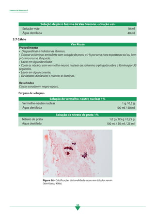 Caderno de Referência 3
• • • • • • • • • • • • • • • • • • •
38
Solução de picro fucsina de Van Gienson - solução uso
Solução-mãe
Água destilada
10 ml
40 ml
Solução de vermelho-neutro nuclear 1%
Vermelho-neutro nuclear
Água destilada
1 g / 0,5 g
100 ml / 50 ml
Solução de nitrato de prata 1%
Nitrato de prata
Água destilada
1,0 g / 0,5 g / 0,25 g
100 ml / 50 ml / 25 ml
3.7 Cálcio
Procedimento
• Desparafinar e hidratar as lâminas.
• Colocar as lâminas em tubete com solução de prata a 1% por uma hora exposto ao sol ou bem
próximo a uma lâmpada.
• Lavar em água destilada.
• Corar os núcleos com vermelho-neutro nuclear ou safranina o pingado sobre a lâmina por 30
segundos.
• Lavar em água corrente.
• Desidratar, diafanizar e montar as lâminas.
Resultados
Cálcio: corado em negro-opaco.
Preparo de soluções
Van Kossa
Figura 16 - Calcificações de tonalidade escura em túbulos renais
(Van Kossa, 400x).
3.indd 38 11/08/12 20:30
 