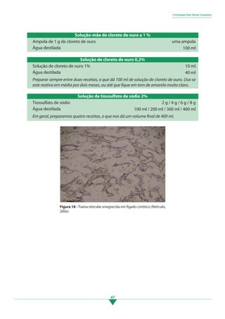 47
Solução-mãe de cloreto de ouro a 1 %
Ampola de 1 g de cloreto de ouro
Água destilada
uma ampola
100 ml
Figura 18 - Trama reticular enegrecida em fígado cirrótico (Retículo,
200x).
4 Coloração Para Tecido Conjuntivo
• • • • • • • • • • • • • • • • • • • • • • • • • • •
Solução de tiossulfato de sódio 2%
Tiossulfato de sódio
Água destilada
2 g / 4 g / 6 g / 8 g
100 ml / 200 ml / 300 ml / 400 ml
Em geral, preparamos quatro receitas, o que nos dá um volume final de 400 ml.
Solução de cloreto de ouro 0,2%
Solução de cloreto de ouro 1%
Água destilada
10 ml
40 ml
Preparar sempre entre duas receitas, o que dá 100 ml de solução de cloreto de ouro. Usa-se
este reativo em média por dois meses, ou até que fique em tom de amarelo muito claro.
3.indd 47 11/08/12 20:30
 