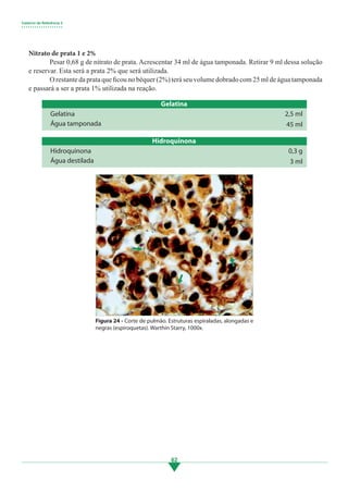 Caderno de Referência 3
• • • • • • • • • • • • • • • • • • •
62
Nitrato de prata 1 e 2%
	 Pesar 0,68 g de nitrato de prata. Acrescentar 34 ml de água tamponada. Retirar 9 ml dessa solução
e reservar. Esta será a prata 2% que será utilizada.
	 O restante da prata que ficou no béquer (2%) terá seu volume dobrado com 25 ml de água tamponada
e passará a ser a prata 1% utilizada na reação.
Gelatina
Gelatina
Água tamponada
2,5 ml
45 ml
Hidroquinona
Hidroquinona
Água destilada
0,3 g
3 ml
Figura 24 - Corte de pulmão. Estruturas espiraladas, alongadas e
negras (espiroquetas). Warthin Starry, 1000x.
3.indd 62 11/08/12 20:30
 