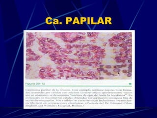 Ca. PAPILAR 