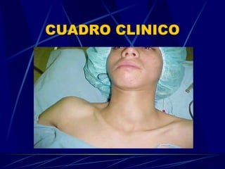 CUADRO CLINICO 