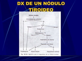 DX DE UN NÓDULO TIROIDEO 