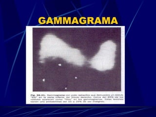 GAMMAGRAMA 