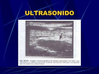 ULTRASONIDO 