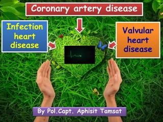 Coronary artery disease 
Valvular 
heart 
disease 
Infection 
heart 
disease 
By Pol.Capt. Aphisit Tamsat 
 