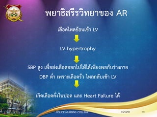 การรักษา MS
•การรักษาด้วยยา
•-blockers, Calcium Channel Blocker, Digoxin
which control heart rate
•Diuretics for fluid overload
•LMWH or cordarone for prevention AF
•NTG for decrease preload โดยมีฤทธิ์ขยายหลอด
เลือดแดงโคโรนารี และลดการใช้ออกซิเจน
13/10/59 101POLICE NURSING COLLEGE
 