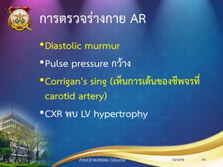 สาเหตุของการเกิด AR
Acute AR
มีสาเหตุจาก
•Endocarditis
•Aortic Dissection
Chronic AR
มีสาเหตุจาก
• Bicuspid aortic valve
• Rheumatic
• Infective endocarditis
13/10/59POLICE NURSING COLLEGE 103
 