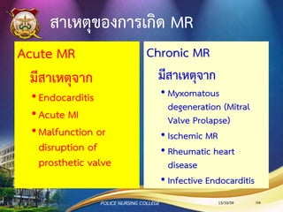 การตรวจร่างกาย AR
•Diastolic murmur
•Pulse pressure กว้าง
•Corrigan's sing (เห็นการเต้นของชีพจรที่
carotid artery)
•CXR พบ LV hypertrophy
13/10/59POLICE NURSING COLLEGE 106
 