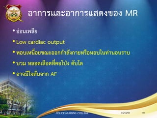 Mitral Regurgitation
13/10/59 108POLICE NURSING COLLEGE
 