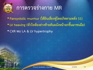 สาเหตุของการเกิด MR
Acute MR
มีสาเหตุจาก
•Endocarditis
•Acute MI
•Malfunction or
disruption of
prosthetic valve
Chronic MR
มีสาเหตุจาก
• Myxomatous
degeneration (Mitral
Valve Prolapse)
• Ischemic MR
• Rheumatic heart
disease
• Infective Endocarditis
13/10/59POLICE NURSING COLLEGE 109
 