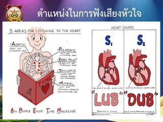 พยาธิสรีรวิทยาของ MR
เลือดไหลย้อนจาก LV ไป LA
LV & LA hypertrophy
ความดันใน pulmonary vein สูงขึ้น เกิด Pulmonary edema
RV failure เกิดท้องมาน และบวมที่ขาทั้ง 2 ข้าง
13/10/59POLICE NURSING COLLEGE 110
 